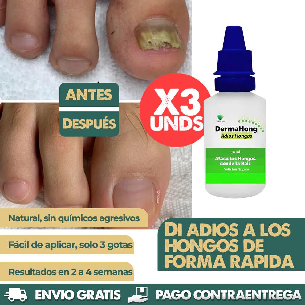 Basta de remedios caros con Dermahong®Resultados probados en 7 días 👣