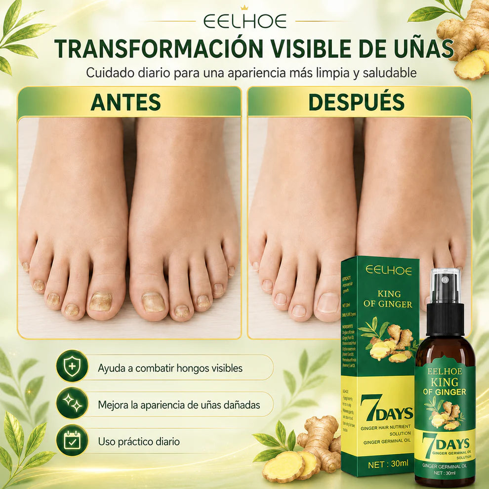 7 Days™ - Aceite Anti Hongos en Uñas